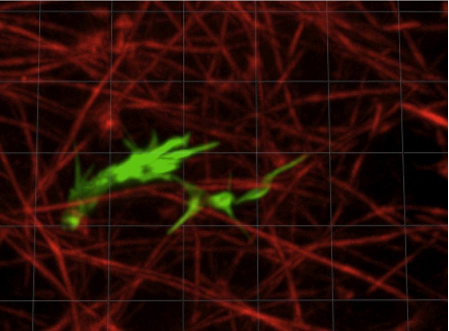 Axon in collagen